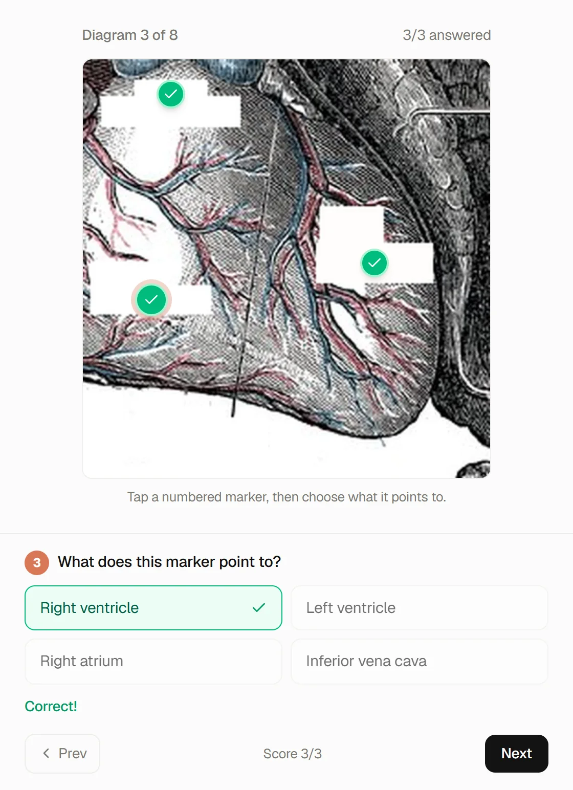 A Labelling quiz on a Gray's Anatomy heart diagram: three numbered markers answered correctly, Right ventricle chosen for marker 3, score 3 of 3.